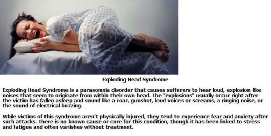 Know About The Crazy Medical Syndromes
