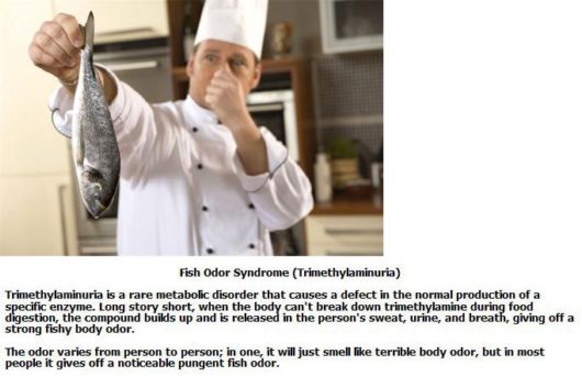 Know About The Crazy Medical Syndromes