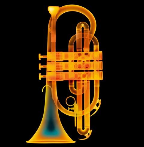 Stunning X-Ray Photographs